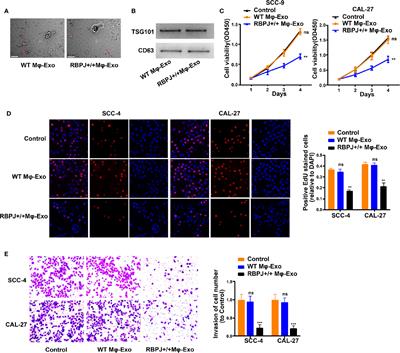 Exosomal LncRNA LBX1-AS1 Derived From RBPJ Overexpressed-Macrophages Inhibits Oral Squamous Cell Carcinoma Progress via miR-182-5p/FOXO3